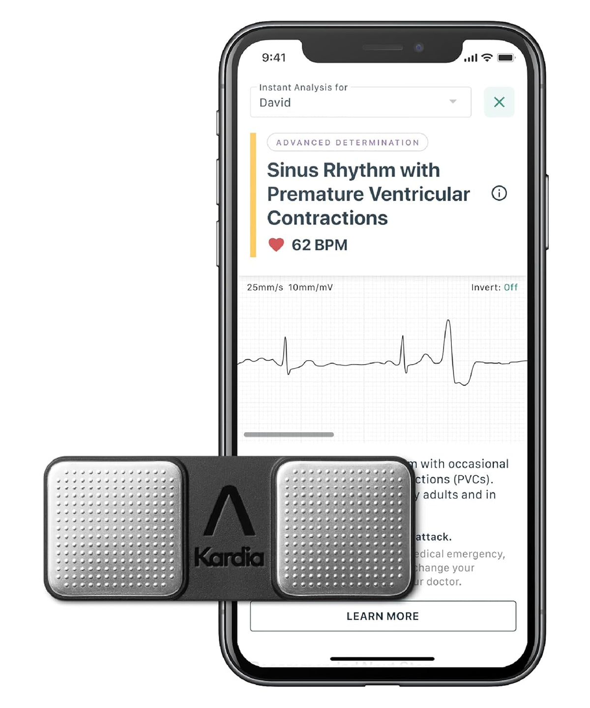 Personal EKG Device and Heart Monitor L822